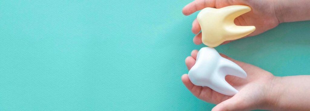 Dientes de leche