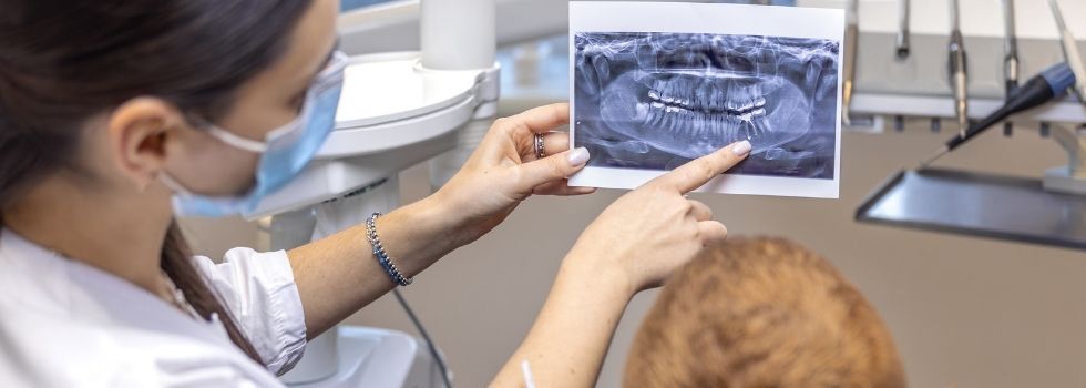 Tratamiento con láser en Clínica Santablanca